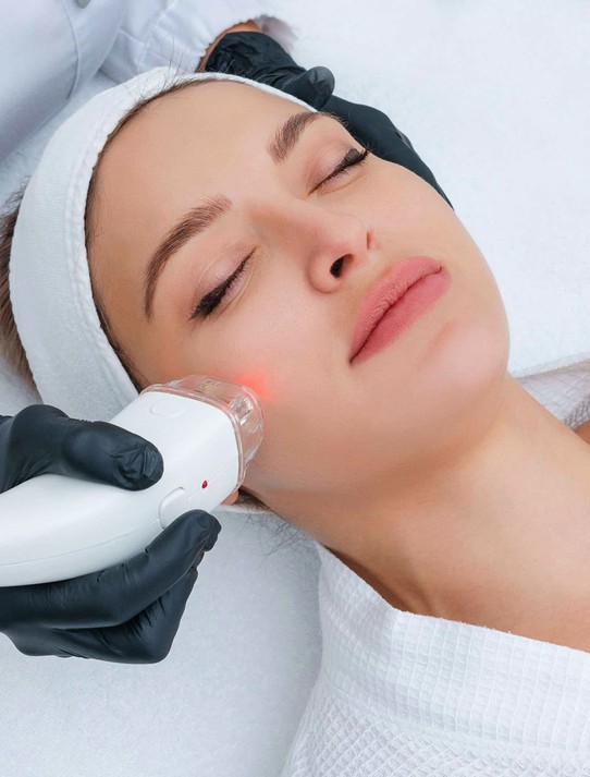 woman getting laser treatment